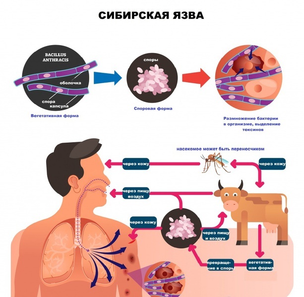 Сибирская язва — особо опасная инфекционная болезнь.